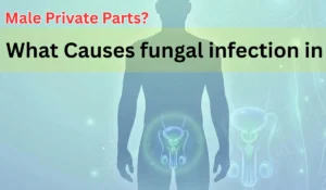 What causes fungal infection in male private parts? Symptoms, Diseases & Prevention Guide