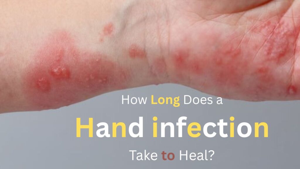 How long does a hand infection take to heal?
