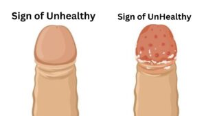 Signs of a healthy penis and signs of an unhealthy penis