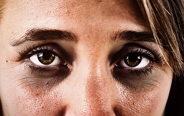 Best cream for dark circles under eyes for women