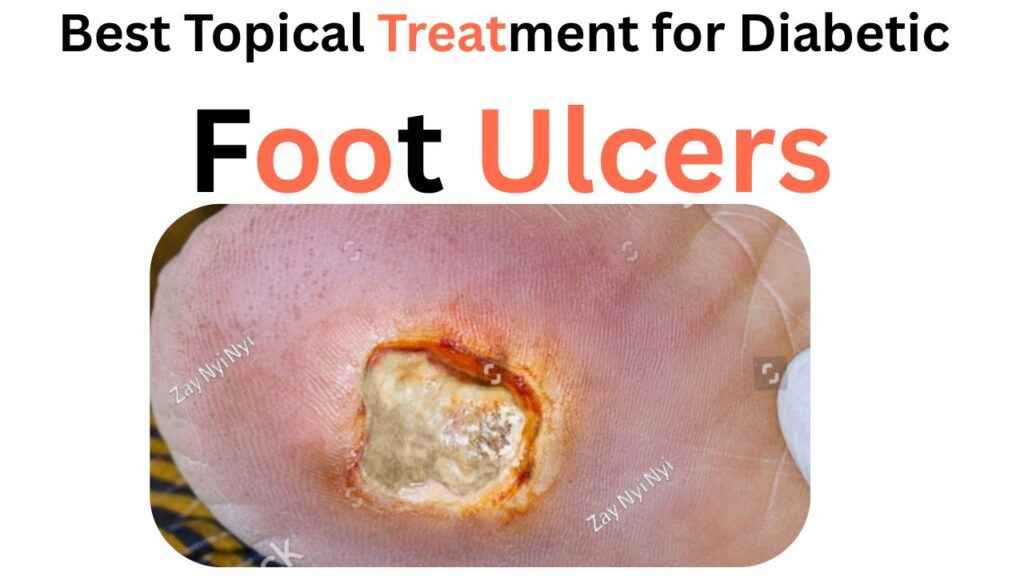 Best topical treatment for diabetic foot ulcers