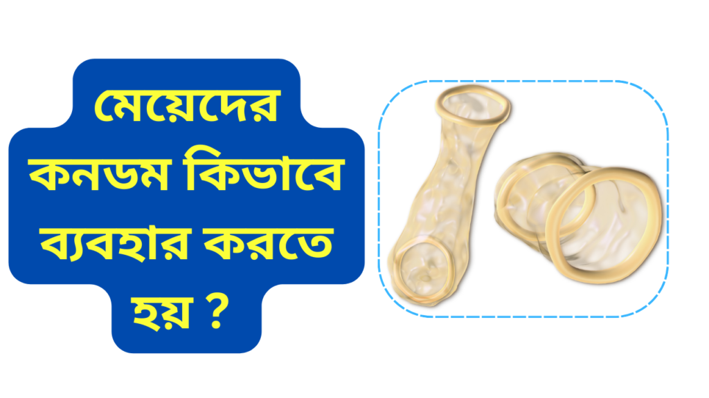 মেয়েদের কনডম কিভাবে ব্যবহার করতে হয় 1 2