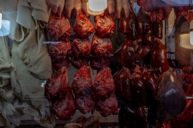 Can a Diabetic Person Eat Hamburger, Beef, Beef Liver, Corned Beef, Ground Beef?
