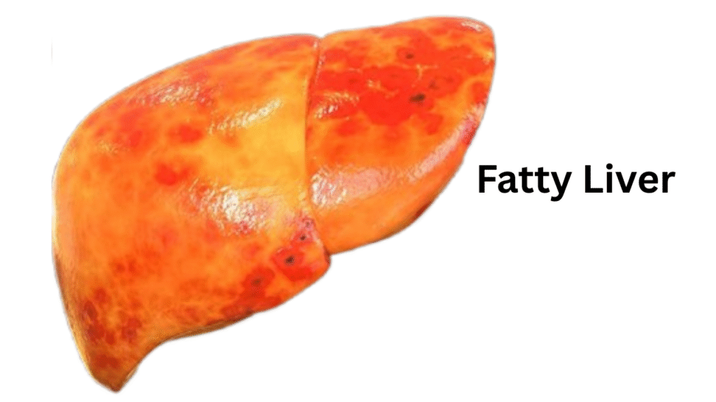 Best Fruits and Vegetables for Fatty Liver Disease